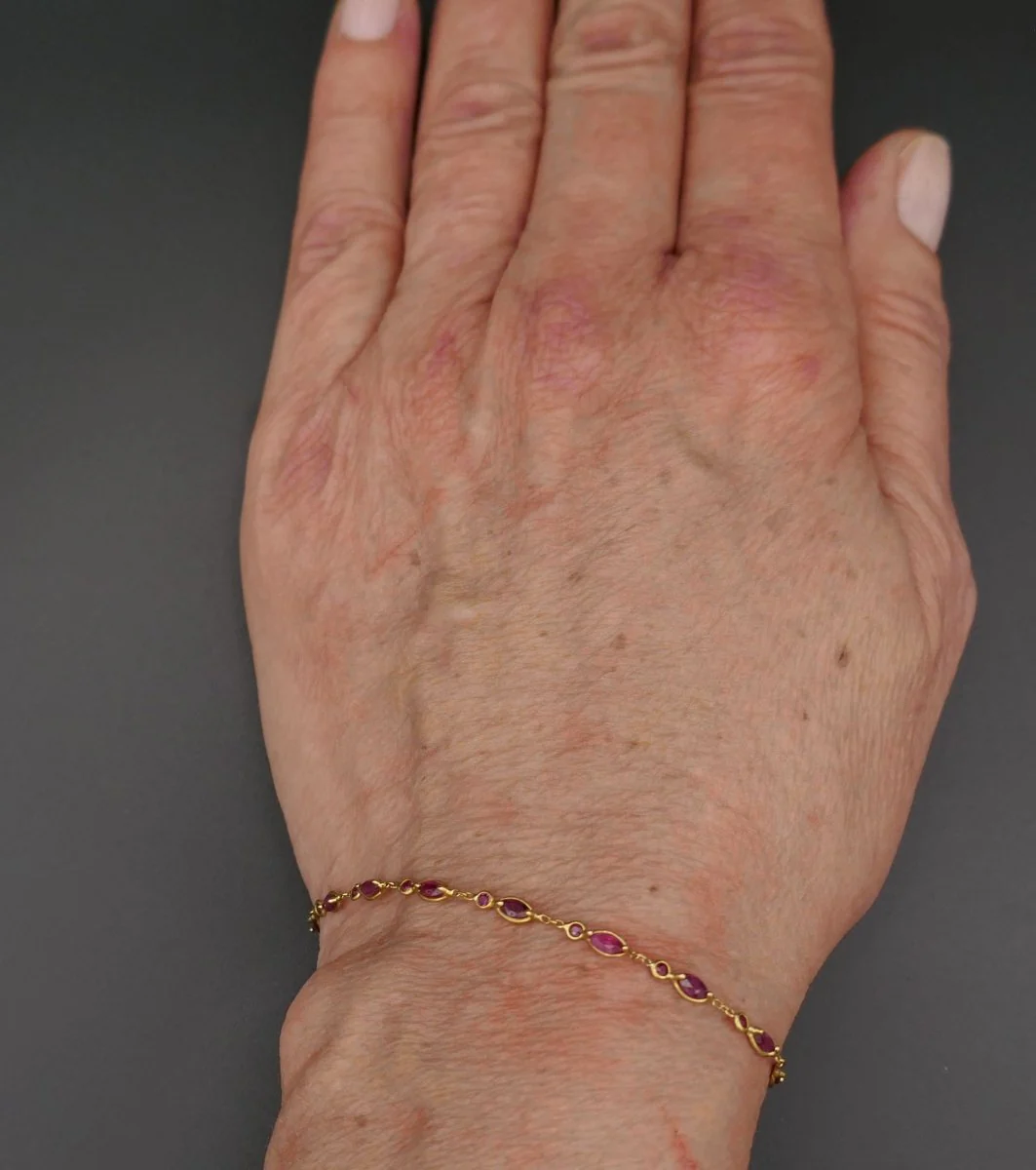 Bracelet Serti De 30 Rubis, Or 18 Carats. - Image 5